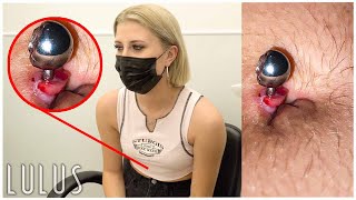 Belly Piercing GONE WRONG PUS PIMPLE 🤢 [upl. by Farhsa]