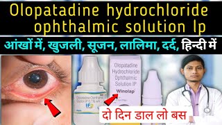 Brimonidine Eye Drop  Drug Information [upl. by Ellekram378]