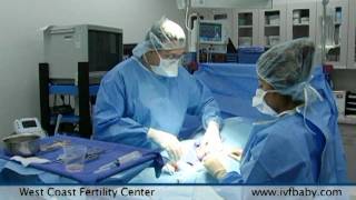 West Coast Fertility Centers Male Infertility Treatments [upl. by Ellennod248]