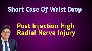 How To Check Radial Nerve Clinically [upl. by Hephzibah]