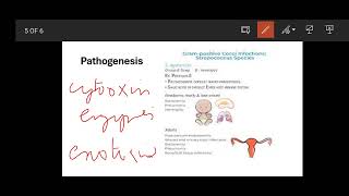 Group B Streptococcus  propertiesDiseasesClinical Featureslab diagnosisTreatment micro mbbs [upl. by Bilac]