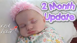 Reflux amp Milk Allergy  2 MONTH BABY UPDATE [upl. by Romina605]