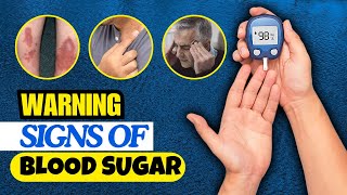 Warning signs Your blood sugar is extremely high [upl. by Yznyl]