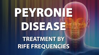 Peyronie Disease  RIFE Frequencies Treatment  Energy amp Quantum Medicine with Bioresonance [upl. by Henebry]