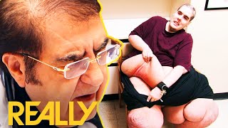 Steven Assanti Tells Dr Now He Stinks Because Of A Rash  My 600 Lb Life Where Are They Now [upl. by Aivizt]