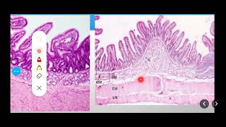 Histology Slides Series Episode 10  Histology of the Small Intestine Duodenum Jejunum Ileum [upl. by Arikal]