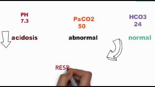 How to interpret ABG in three steps very easy steps [upl. by Festus]