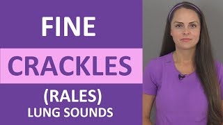 Fine Crackles Rales Lung Sound Causes Breath Sounds Audio Nursing [upl. by Okwu]