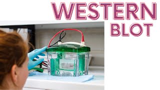 Western blot  Western blotting technique explained [upl. by Ynnelg]