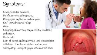 Pharyngitis  Symptoms causes and Treatment Streptococcal pharyngitis [upl. by Harvie]