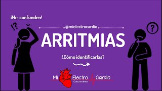 ARRITMIAS CARDÍACAS  GUÍA  MIELECTROCARDIO [upl. by Selestina]