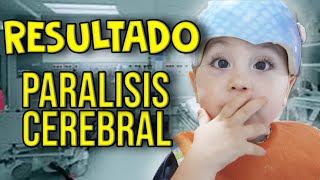 ¿QUE NOS HAN DICHO EN PARÁLISIS CEREBRAL INFANTIL  NURYCALVO Y SU FAMILIA [upl. by Akerue]