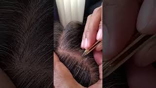 most satisfying White hair removal 060stressremoval satisfying [upl. by Hcurab343]