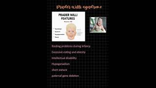 PRADER WILLI SYNDROME MNEMONIC fmge study MBBS [upl. by Ydnolem]