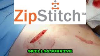 ZIPSTITCH  CLOSE a wound in the Backcountry [upl. by Elolcin]