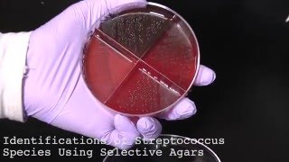 9 How to Identify Streptococcus Species Using Selective Agars [upl. by Ymmor]