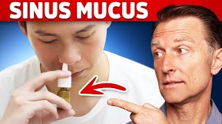 The 1 Remedy for Sinus Mucus  Pressure  Postnasal Drip [upl. by Dymphia]