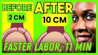 How to Dilate Cervix Faster Cervix Opening Exercise  DOCTOR V  S1E4 [upl. by Eiclud]