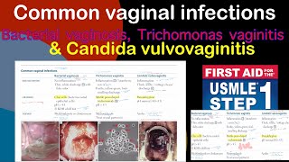 Common vaginal infections Bacterial vaginosis Trichomanas vaginitis amp Candida vulvovaginitis [upl. by Starinsky]