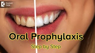 Oral Prophylaxis Step by Step  Dr Gopathi Haritha [upl. by Naujat]