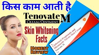 Tenovate M Skin Cream Ke Fayde  Clobetasol amp Miconazole Ointment For Fungal Infection In Hindi [upl. by Anwad]