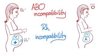 ABO incompatibility vs Rh incompatibility [upl. by Anelah671]