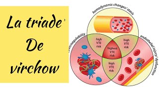 🔴la triade de VIRCHOW ET LA THROMBOSE VEINEUSE PROFONDE [upl. by Adgam]