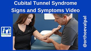 Cubital Tunnel Syndrome Signs and Symptoms [upl. by Shugart]