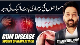 Gum Disease A Hidden Source of Heart Attack [upl. by Okomot]