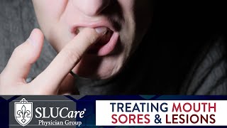 Mouth Sores amp Lesions Diagnosing and Treatment  SLUCare Otolaryngology [upl. by Atsira]