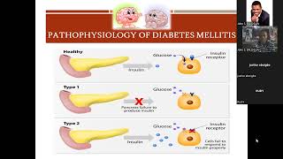 DIABETIC KETOACIDOSIS IN PAEDIATRICS [upl. by Myrwyn695]