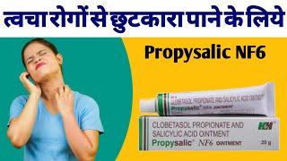 Propsaslic NF6 Ointment Uses Benefits And Side Effects In hindi  Clobetasol Propionate Cream [upl. by Demitria]