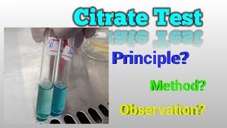 Citrate Test Microbiology [upl. by Frohne]