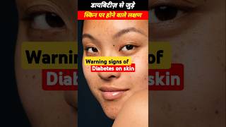 Warning signs of diabetes on skin diabetes diabetescare [upl. by Boleyn242]