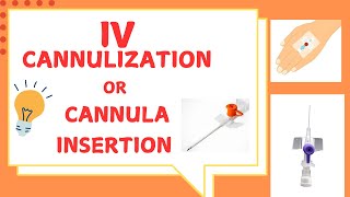 IV CANNULIZATIONCANNULA INSERTION IV cannula procedure IV CANNULIZATION TECHNIQUE [upl. by January]