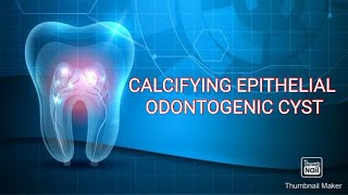 CALCIFYING EPITHELIAL ODONTOGENIC CYST CEOC [upl. by Jac]