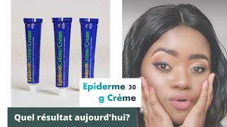 Mon avis sur épiderme 30g aujourdhui comment choisir sa crème de visage🙄🙄 [upl. by Aloz63]