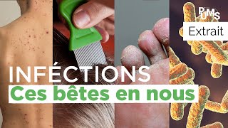 Les 4 petites bêtes qui nous infectent  Pour une meilleure santé pums [upl. by Timus]