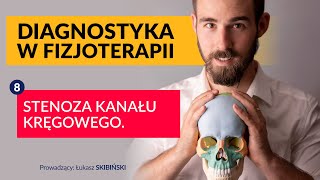 Stenoza kanału kręgowego Diagnostyka w fizjoterapii Odcinek 8 [upl. by Irep]