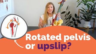 Rotated pelvis or upslip [upl. by Campagna]