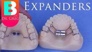 BRACES EXPLAINED Palatal Expanders [upl. by Collie]