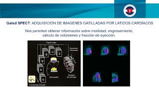Estudios de Perfusión Miocárdica  SPECT [upl. by Corly]
