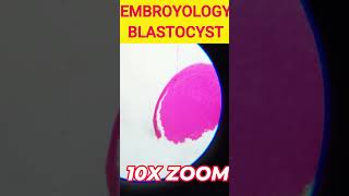 Embroyology Blastocyst cbsebiology icsebiology microscopy blastocyst microscopeworld [upl. by Anairda632]