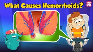 What are Piles  What Causes Hemorrhoids  Hemorrhoids Symptoms and Prevention  Dr Binocs Show [upl. by Juno]