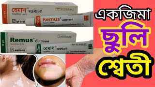 remus ointment 01 banglatacrolimus ointment 003 ww uses in banglaবিস্তারিত জেনে নিন [upl. by Trimble351]