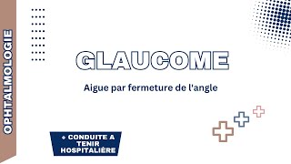 Glaucome aigue par fermeture de langle Rappel physiopathologie formes cliniques DC positif CAT [upl. by Brainard]