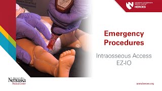 Emergency Procedures Intraosseous Access  EZIO [upl. by Jr]