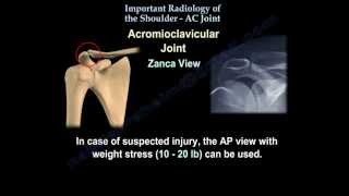 The Shoulder AC JOINT radiology  Everything You Need To Know  Dr Nabil [upl. by Assenahs464]