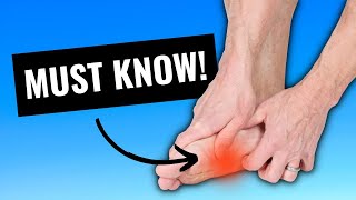 Plantar Fasciitis 4 Things You Must Do To Stop The Pain [upl. by Umeko]