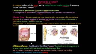 111P  What is a tumor Classification of Neoplasms  Benign and Malignant [upl. by Ranzini]